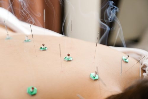 acupuncture-and-moxibustion-effect_ic